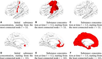 On propagation in networks, promising models beyond network diffusion to describe degenerative brain diseases and traumatic brain injuries